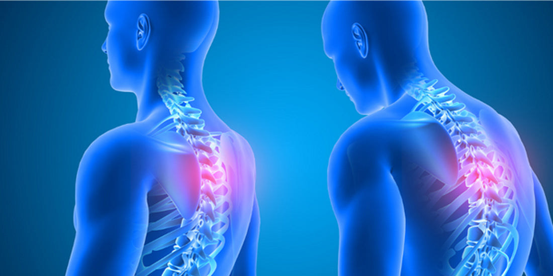 Improving Posture with Chiropractic Care: Can a Chiropractor Fix Bad Posture?